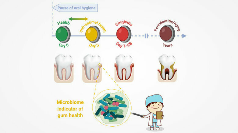 中科院研究人员提出“牙龈亚健康”概念及其与牙龈牙周疾病的关联