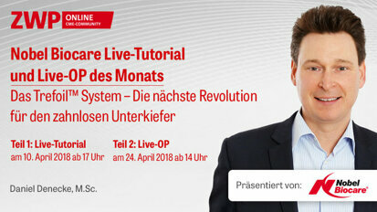 Nobel Biocare Live-Praxis-Tutorial & Live-OP: Das Trefoil System